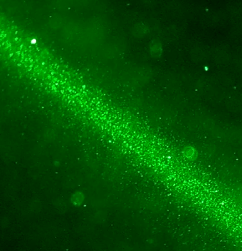 Tiny particles